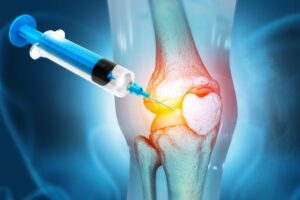 PRP Vs Hyaluronic Acid For Knee