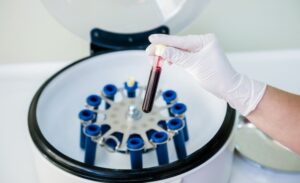 What is Platelet Rich Plasma